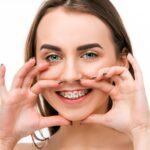 Nowoczesne podejście - Stomatolog Dental Piotrków 7 beautiful young woman with teeth braces 155003 5633
