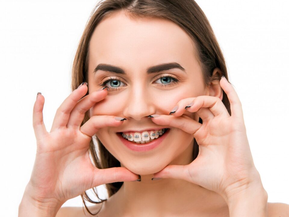 beautiful young woman with teeth braces 155003 5633