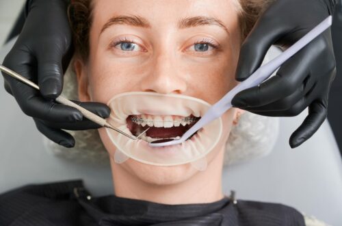 Dentysta Piotrków
