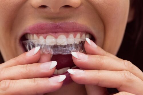 ortodonta dental piotrkow