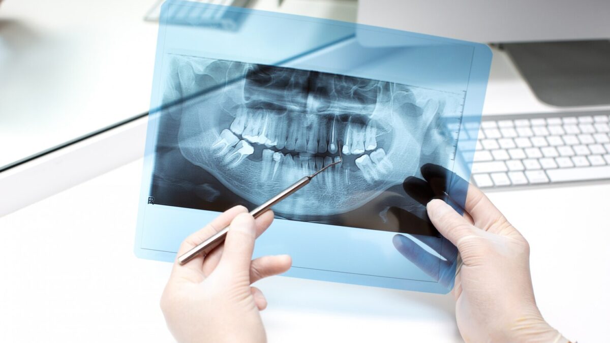 dentist analyzes x ray photo 140725 7685