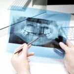 Ortodoncja – klucz do zdrowego i pięknego uśmiechu 7 dentist analyzes x ray photo 140725 7685