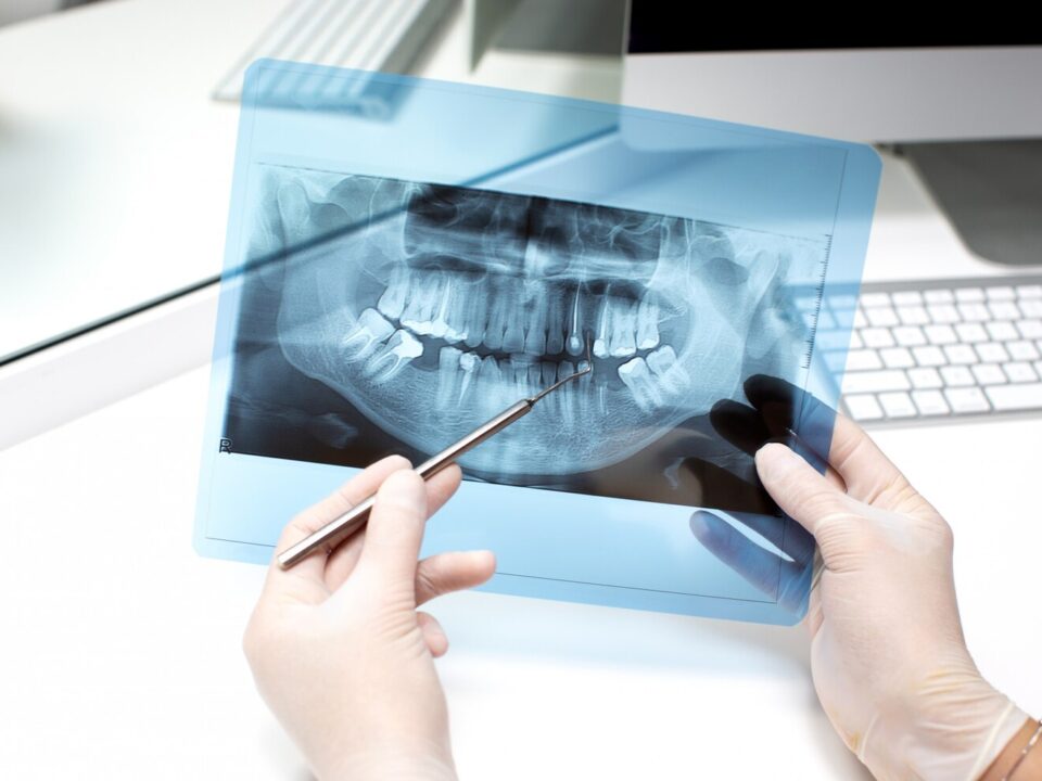 dentist analyzes x ray photo 140725 7685